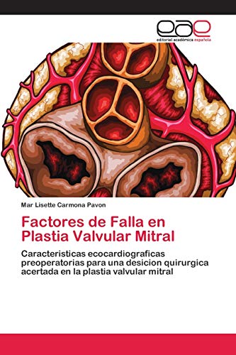 Stock image for Factores de Falla en Plastia Valvular Mitral for sale by Chiron Media