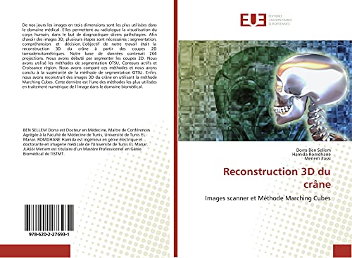 9786202276931: Reconstruction 3D du crne: Images scanner et Mthode Marching Cubes (French Edition)