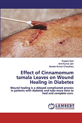 Stock image for Effect of Cinnamomum tamala Leaves on Wound Healing in Diabetes: Wound healing is a delayed complicated process in patients with diabetes and take more time to heal and complete cure. for sale by Lucky's Textbooks