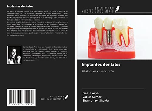 9786202855426: Implantes dentales: Obstculos y supervisin