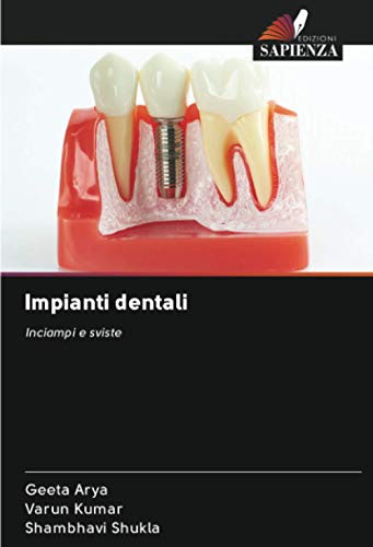 9786202855457: Impianti dentali: Inciampi e sviste