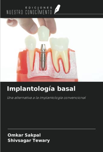 9786202981712: Implantologa basal: Una alternativa a la implantologa convencional (Spanish Edition)