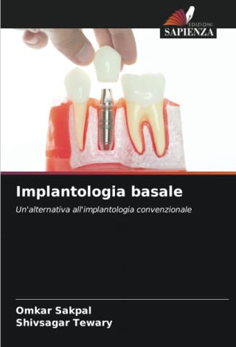 9786202981736: Implantologia basale: Un'alternativa all'implantologia convenzionale (Italian Edition)
