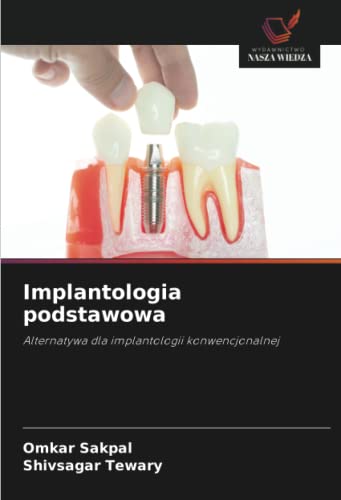 9786202981750: Implantologia podstawowa: Alternatywa dla implantologii konwencjonalnej (Polish Edition)