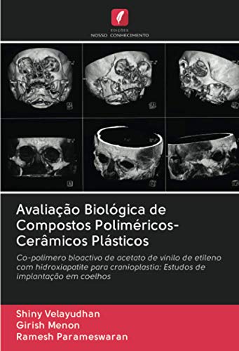 9786203044546: Avaliao Biolgica de Compostos Polimricos-Cermicos Plsticos: Co-polmero bioactivo de acetato de vinilo de etileno com hidroxiapatite para cranioplastia: Estudos de implantao em coelhos