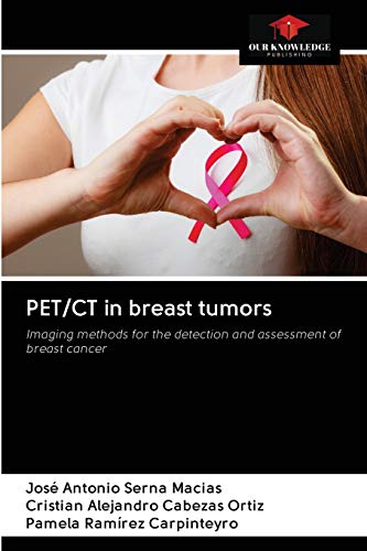 Imagen de archivo de PET/CT in breast tumors: Imaging methods for the detection and assessment of breast cancer a la venta por Lucky's Textbooks