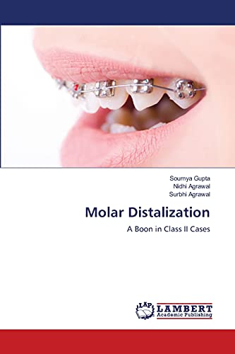 Stock image for Molar Distalization: A Boon in Class II Cases for sale by Lucky's Textbooks