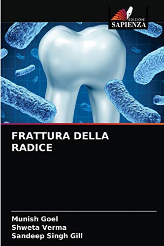 Stock image for Frattura Della Radice (Italian Edition) for sale by Lucky's Textbooks