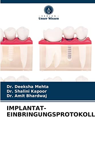 Imagen de archivo de Implantat-Einbringungsprotokoll (German Edition) a la venta por Lucky's Textbooks