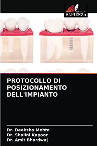 Imagen de archivo de PROTOCOLLO DI POSIZIONAMENTO DELL'IMPIANTO (Italian Edition) a la venta por Lucky's Textbooks