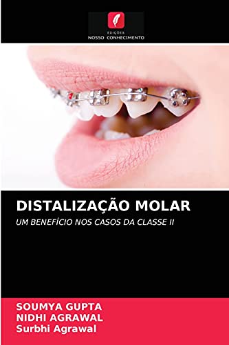 Stock image for DISTALIZAO MOLAR: UM BENEFCIO NOS CASOS DA CLASSE II (Portuguese Edition) for sale by Lucky's Textbooks