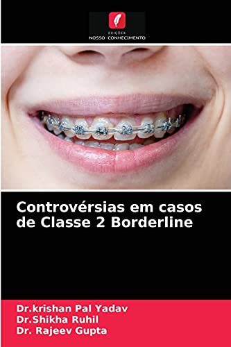 Stock image for Controvrsias em casos de Classe 2 Borderline (Portuguese Edition) for sale by Lucky's Textbooks