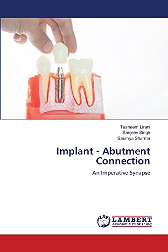 Stock image for Implant - Abutment Connection: An Imperative Synapse for sale by Lucky's Textbooks