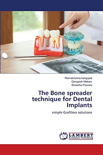 Stock image for The Bone spreader technique for Dental Implants: simple Graftless solutions for sale by Lucky's Textbooks