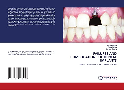 Stock image for FAILURES AND COMPLICATIONS OF DENTAL IMPLANTS: DENTAL IMPLANTS & ITS COMPLICATIONS for sale by Books Puddle