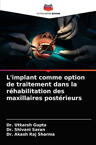 9786204032368: L'implant comme option de traitement dans la rhabilitation des maxillaires postrieurs