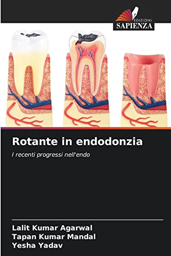 9786204174365: Rotante in endodonzia: I recenti progressi nell'endo