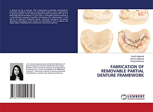Stock image for FABRICATION OF REMOVABLE PARTIAL DENTURE FRAMEWORK for sale by Books Puddle
