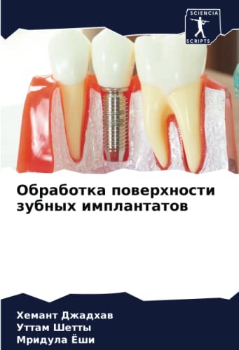9786204219370: Обработка поверхности зубных имплантатов