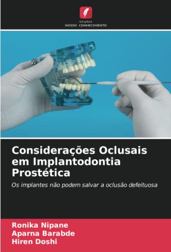 9786204220239: Consideraes Oclusais em Implantodontia Prosttica: Os implantes no podem salvar a ocluso defeituosa