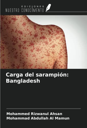 9786204452487: Carga del sarampin: Bangladesh (Spanish Edition)