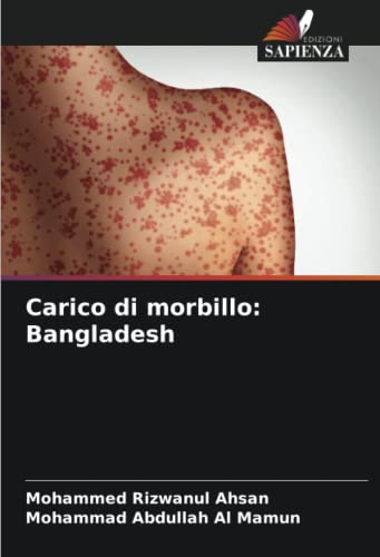 9786204452500: Carico di morbillo: Bangladesh (Italian Edition)