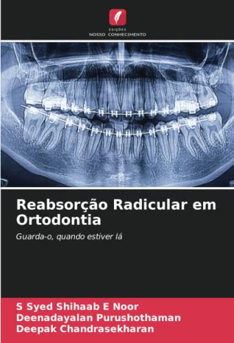 Stock image for Reabsorção Radicular em Ortodontia for sale by Ria Christie Collections