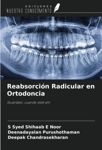 Stock image for Reabsorcin Radicular en Ortodoncia: Gurdalo, cuando est ah (Spanish Edition) for sale by GF Books, Inc.