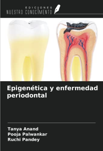 9786204610719: Epigentica y enfermedad periodontal (Spanish Edition)