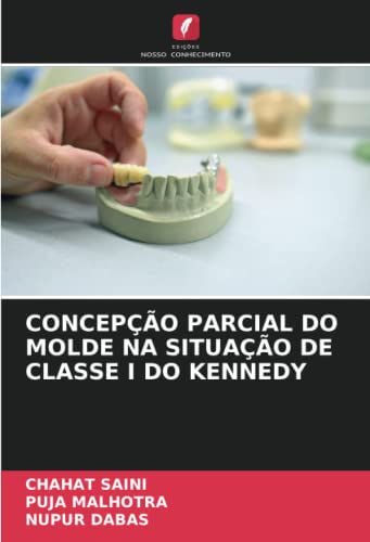 9786204702155: CONCEPO PARCIAL DO MOLDE NA SITUAO DE CLASSE I DO KENNEDY