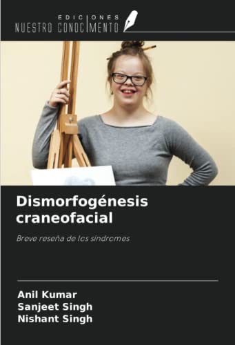 9786204805092: Dismorfognesis craneofacial: Breve resea de los sndromes (Spanish Edition)