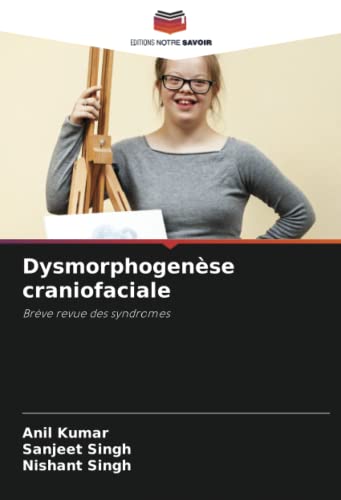 9786204805108: Dysmorphogense craniofaciale: Brve revue des syndromes (French Edition)