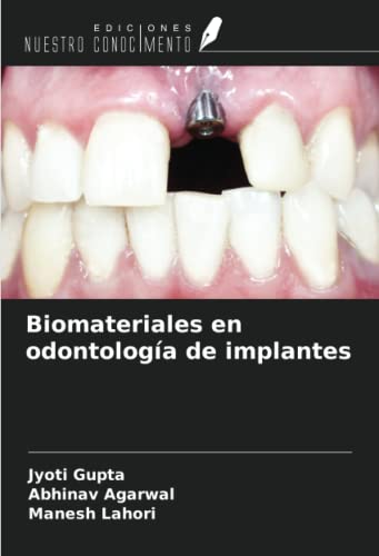 9786204865522: Biomateriales en odontologa de implantes