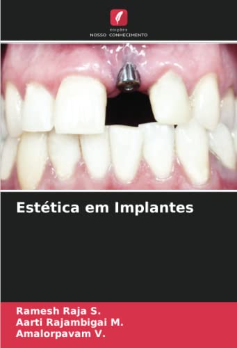 9786205073919: Esttica em Implantes