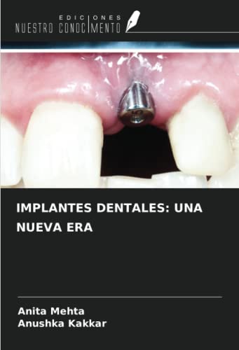 Beispielbild fr IMPLANTES DENTALES: UNA NUEVA ERA zum Verkauf von BuchWeltWeit Ludwig Meier e.K.