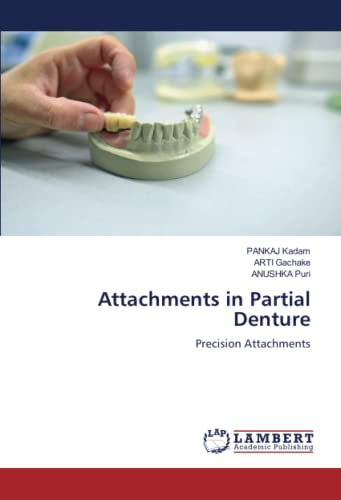 Stock image for Attachments in Partial Denture : Precision Attachments for sale by AHA-BUCH GmbH