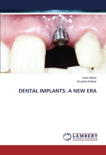 Beispielbild fr DENTAL IMPLANTS: A NEW ERA zum Verkauf von BuchWeltWeit Ludwig Meier e.K.