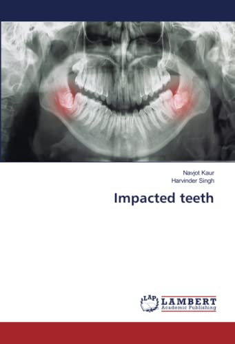 9786205525784: Impacted teeth