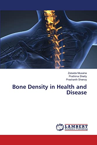 Stock image for Bone Density in Health and Disease for sale by California Books