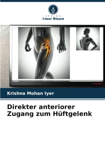 Stock image for Direkter anteriorer Zugang zum Hüftgelenk for sale by Ria Christie Collections