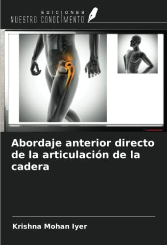 9786205678954: Abordaje anterior directo de la articulacin de la cadera (Spanish Edition)