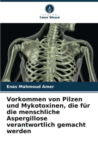9786205832486: Vorkommen von Pilzen und Mykotoxinen, die fr die menschliche Aspergillose verantwortlich gemacht werden (German Edition)