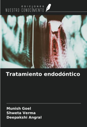 9786205965733: Tratamiento endodntico (Spanish Edition)