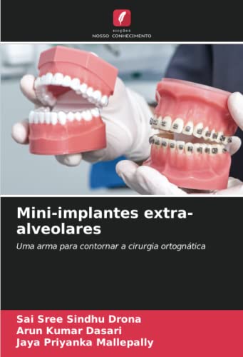 Beispielbild fr Mini-implantes extra-alveolares zum Verkauf von GreatBookPrices