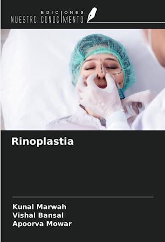 Stock image for Rinoplastia for sale by BuchWeltWeit Ludwig Meier e.K.