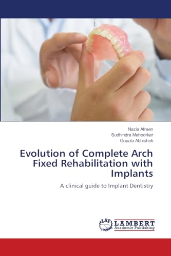 Stock image for Evolution of Complete Arch Fixed Rehabilitation with Implants: A clinical guide to Implant Dentistry for sale by Books Puddle