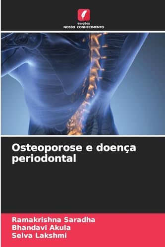 Beispielbild fr Osteoporose e doen a periodontal (Portuguese Edition) zum Verkauf von Mispah books