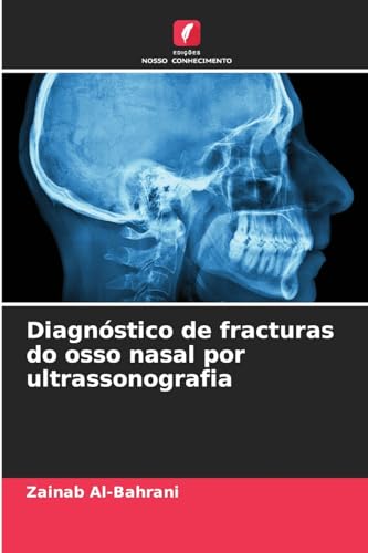 Imagen de archivo de Diagnstico de fracturas do osso nasal por ultrassonografia (Portuguese Edition) a la venta por Ria Christie Collections