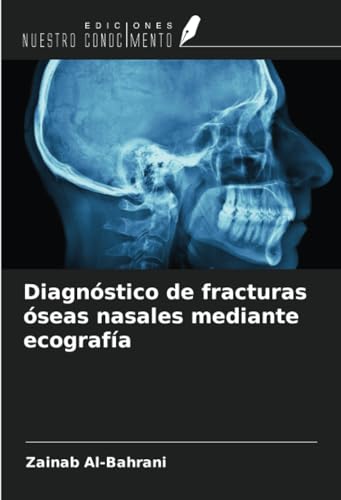 9786206449416: Diagnstico de fracturas seas nasales mediante ecografa