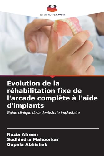 9786206615453: volution de la rhabilitation fixe de l'arcade complte  l'aide d'implants (French Edition)